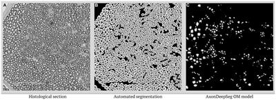 Automated pipeline for nerve fiber selection and g-ratio calculation in optical microscopy: exploring staining protocol variations